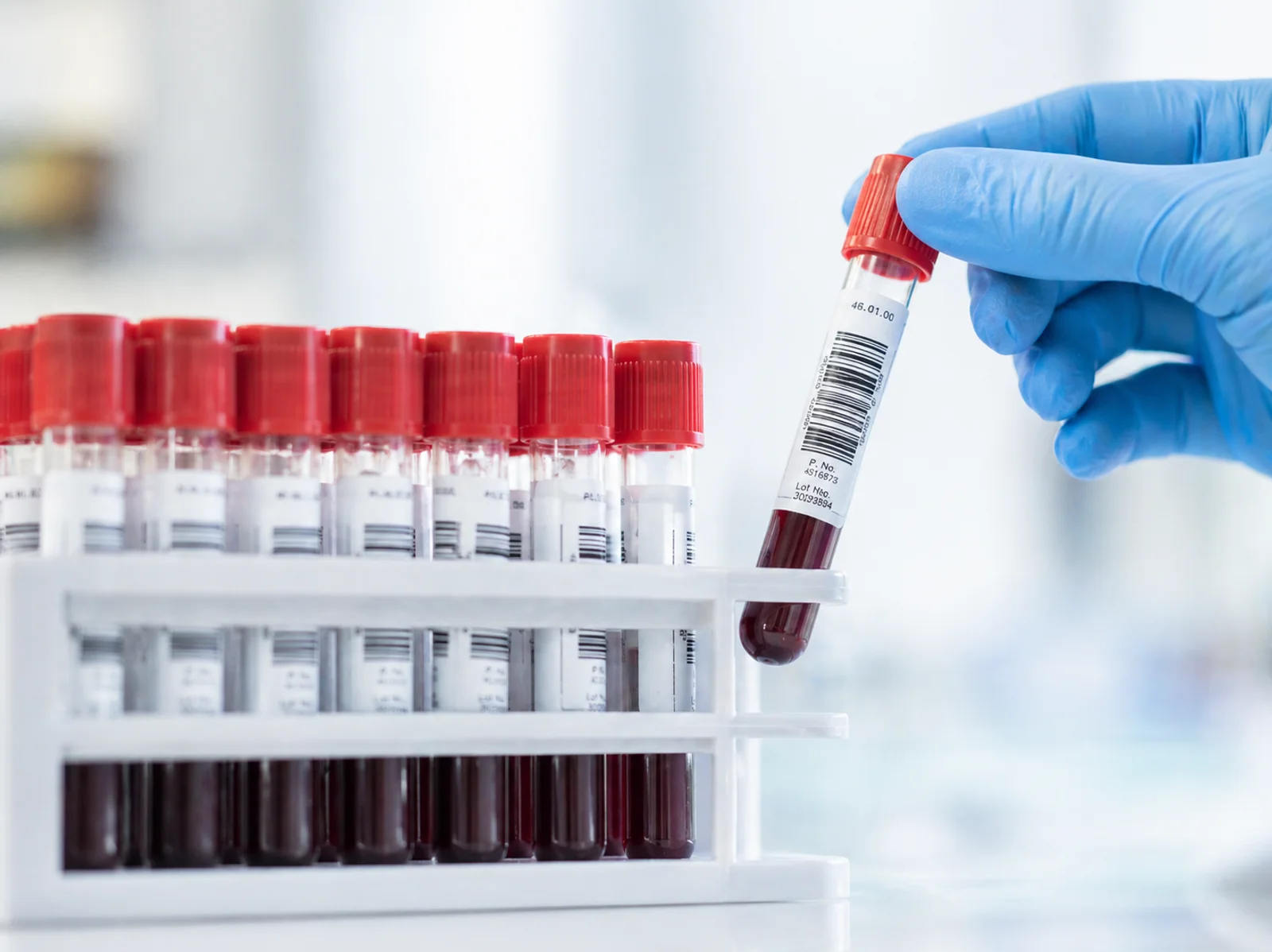 Análisis Clínicos y Toxicológicos - Antidoping, ADN, química forense